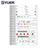 YUER™️ LED 150W Beam Spot Zoom Wash 3in1 Moving Head Lighting DMX512 For Dj Disco Night Club Wedding